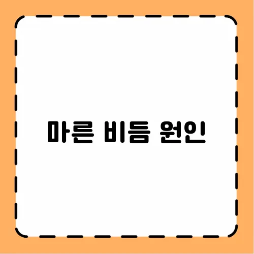 마른 비듬 원인