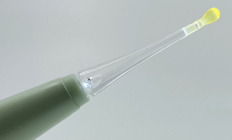 편도결석 빼는법 원인 제거 가글 방법 완화하기!