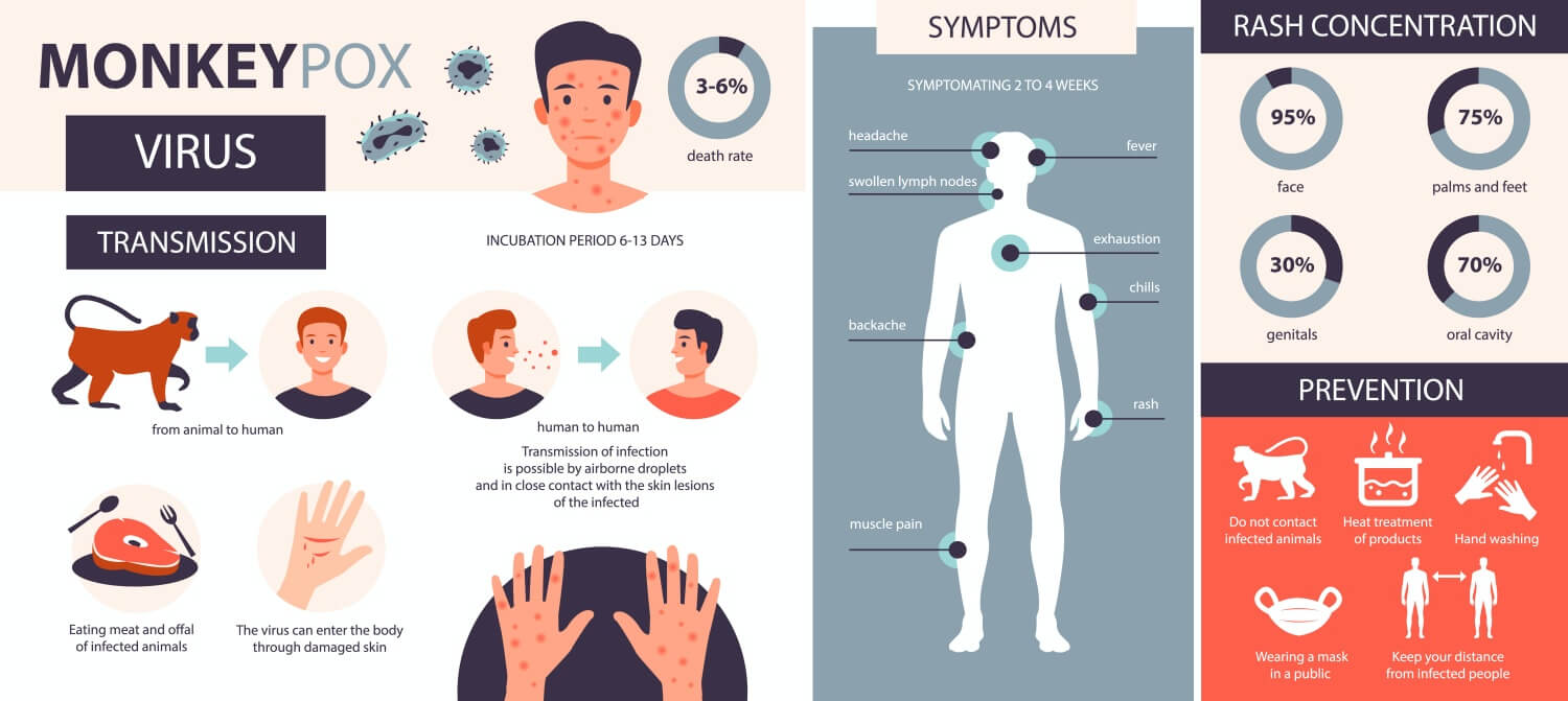 엠폭스-전반적인-개요-전염-증상-예방