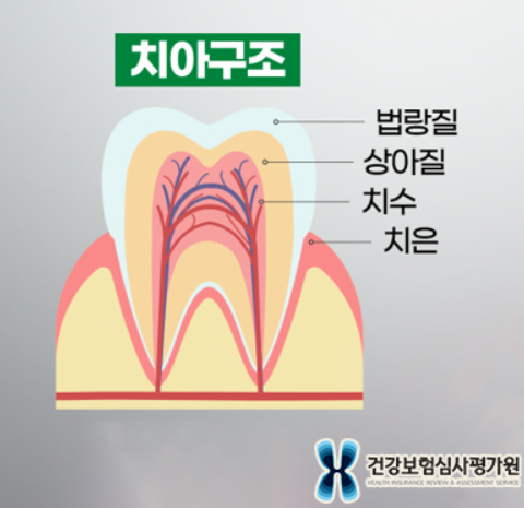 치아의 구조&#44; 치아는 법랑질이 상아질을 둘러싸고 있는 형태로 되어 있다.