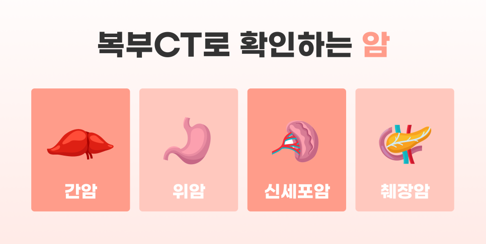 복부CT