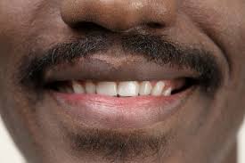 잇몸이 붓고 아플 때