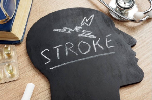 병과 멀어지는 영양정보 - 뇌혈관 장애(뇌졸증)