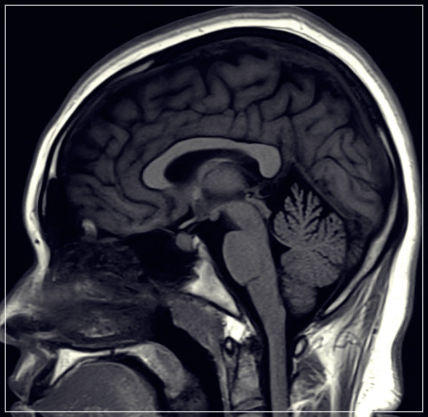 코일색전술 보험: 비용, 재발 위험, 보험의 중요성에 대해 알아보기