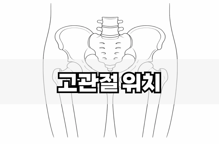 고관절 위치
