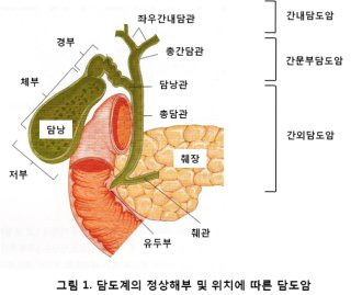 담도암 담낭암 차이