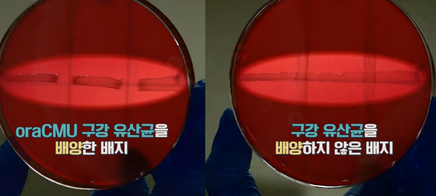 구강유산균 효과