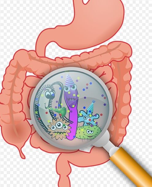 장에 세균과 염증이 있는 그림입니다.