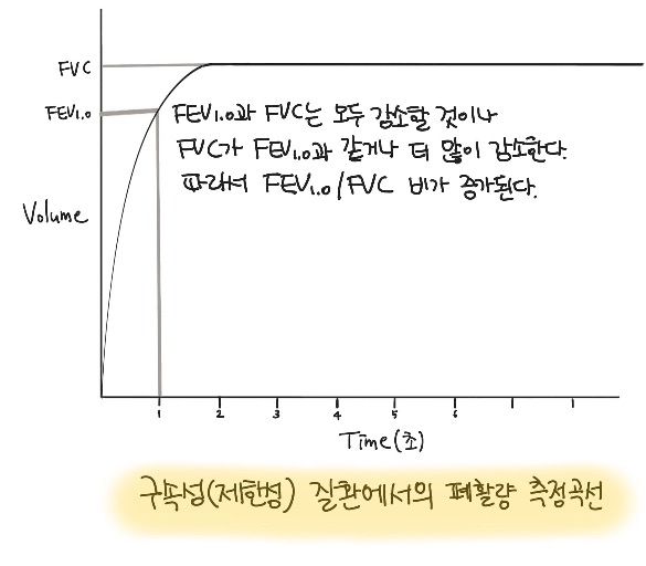 구속성(제한성) 질환에서의 폐활량 측정곡선
