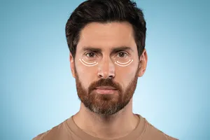 하안검 수술 회복기간