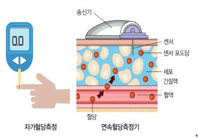 공복혈당수치