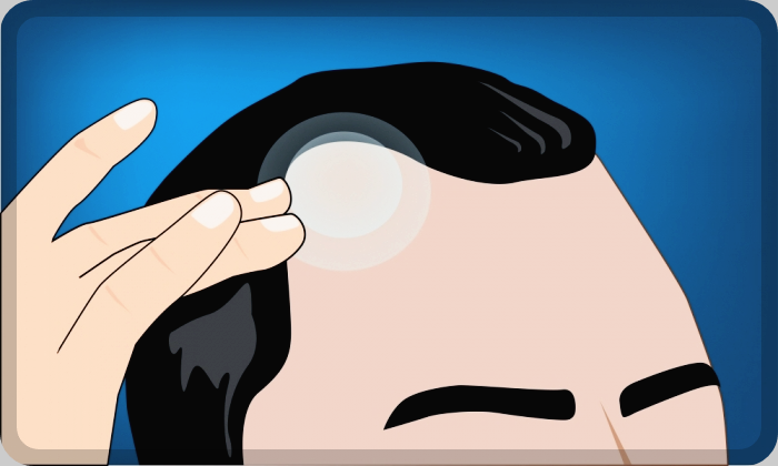 아르기닌-부작용