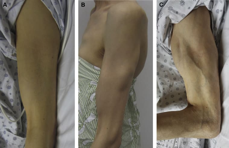 팝 가수 셀린 디온, 희귀병 전신근강직증후군(SPS) 진단 받아 VIDEO: Celine Dion, 54, is diagnosed with incurable neurological disease