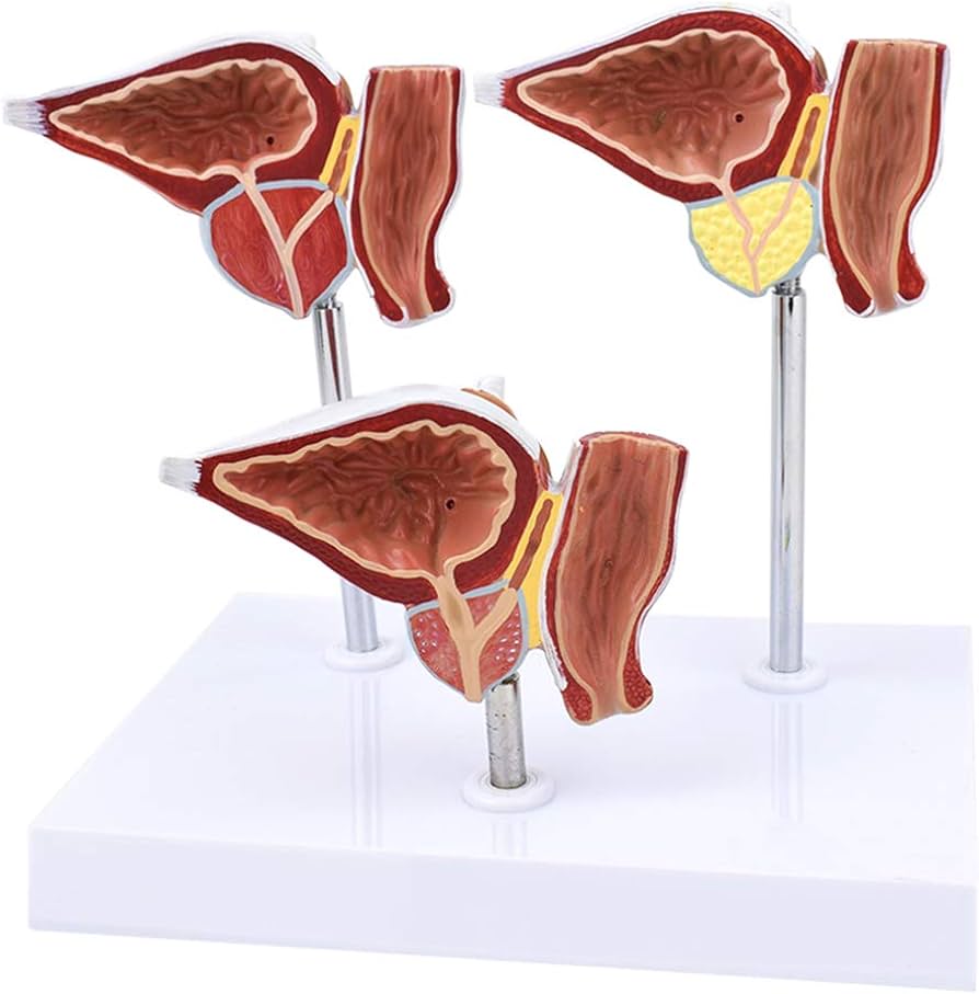전립선비대증-좋은음식