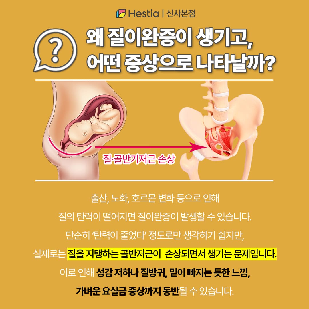 왜 이완증이 생기고, 어떤 증상으로 나타날까?