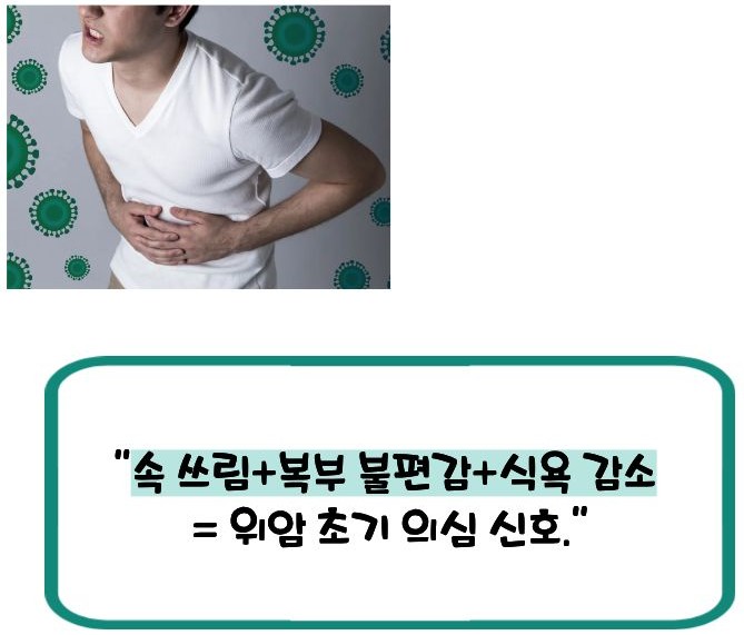 위암 초기증상