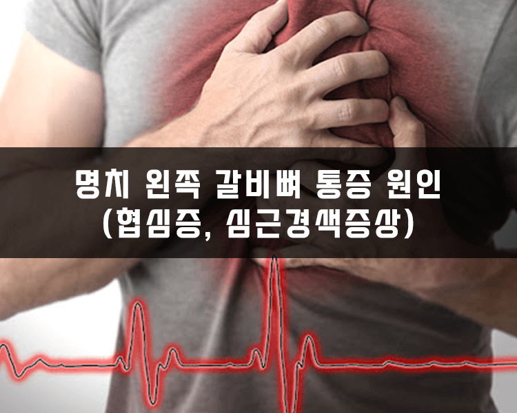 명치 왼쪽 갈비뼈 통증 원인 - 협심증, 심근경색증상