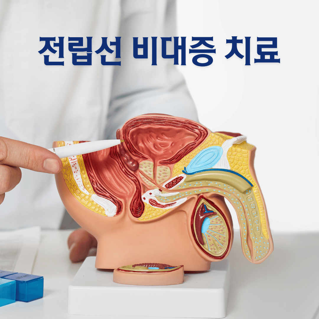 전립선 비대증 치료: 증상 완화부터 완치까지