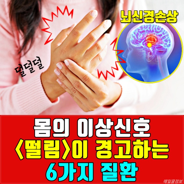 손떨림, 눈떨림, 얼굴떨림, 턱떨림, 뺨떨림 증상 이유 원인