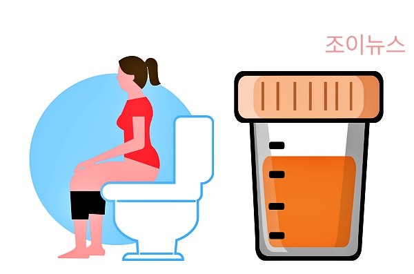 방광염의 대표적 진단 방법인 '소변 검사'