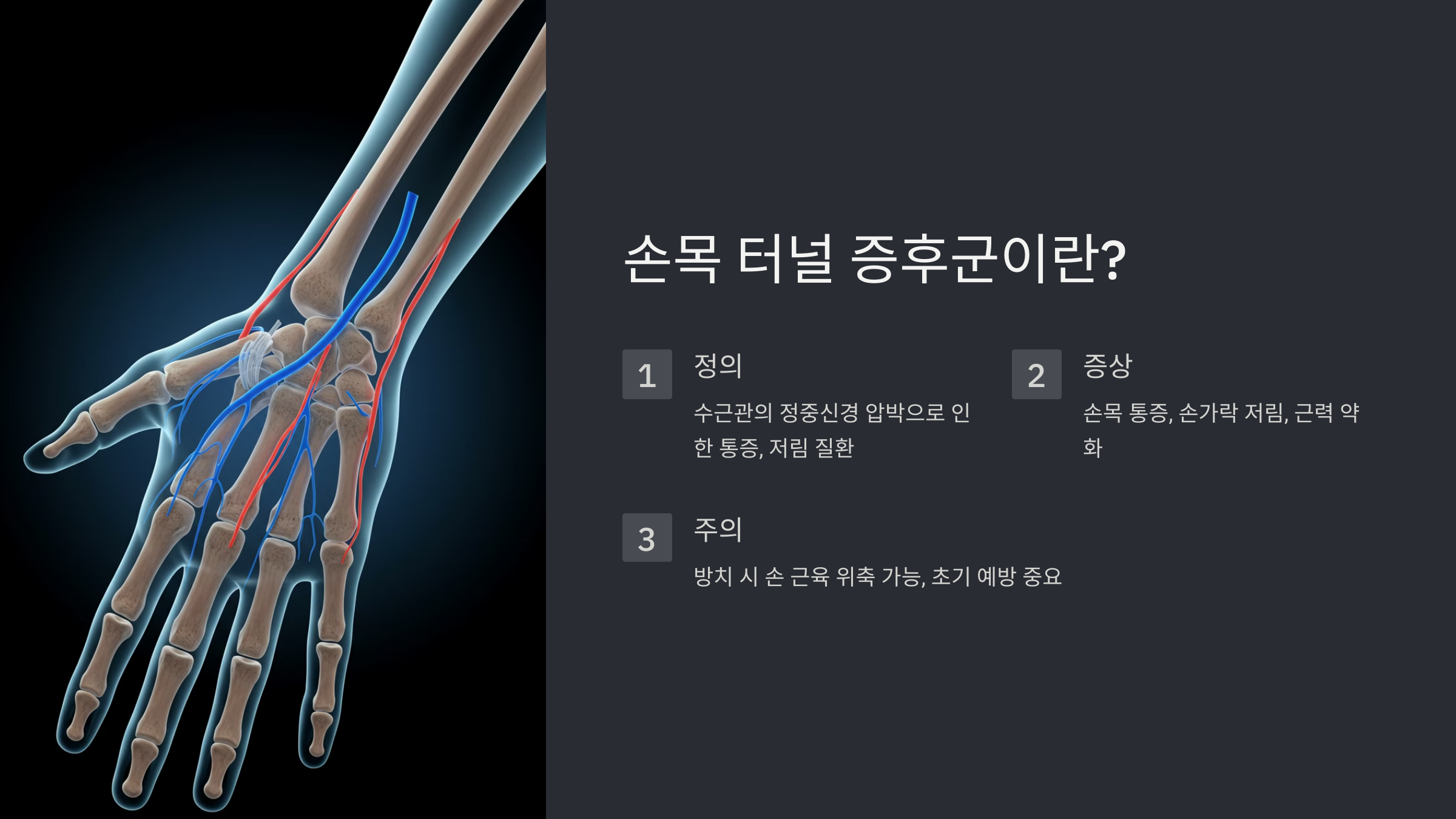 1. 손목 터널 증후군이란?
