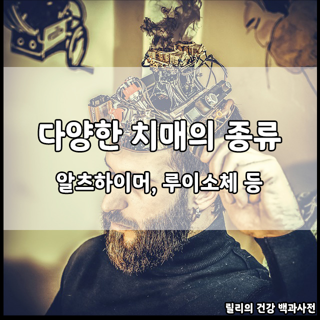 다양한 치매의 종류
알츠하이머&#44; 루이소체 등
릴리의 건강 백과사전