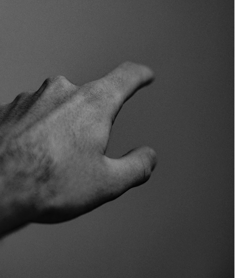 손가락혈관종: 원인, 증상 및 관리 방법 예방