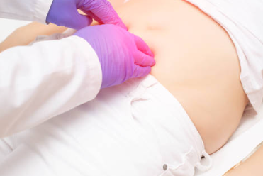 탈장 증세 수술 입원 기간 탈장 수술 후 관리 원인 탈장 수술 후유증