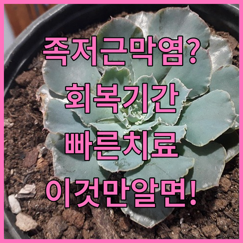 족저근막염 회복 기간과 빠른 치료 방..