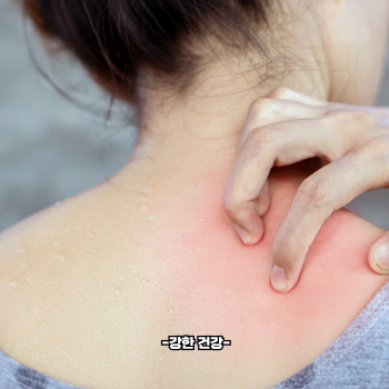 스키터 증후군 증상