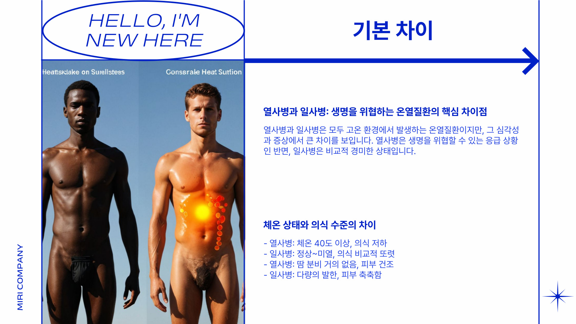 열사병과 일사병의 차이
