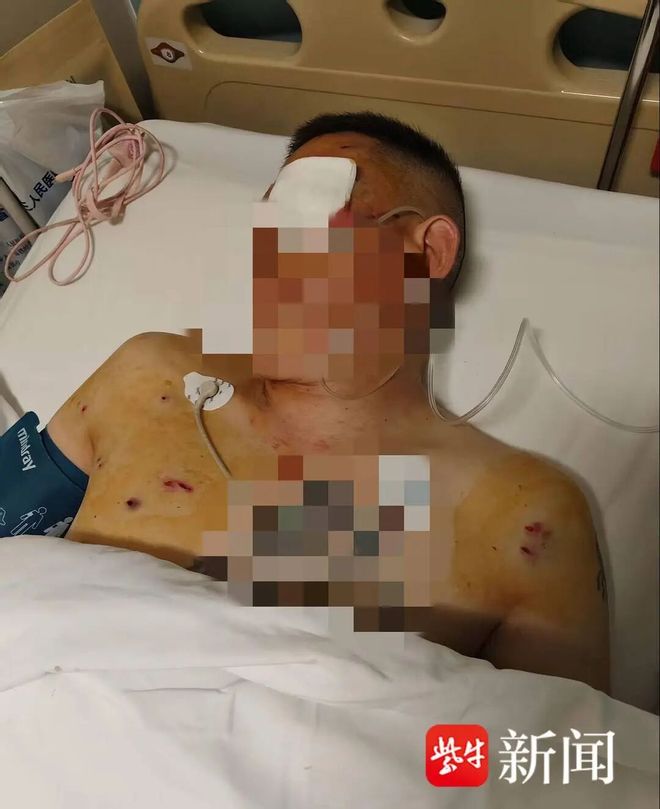 은행 앞에서 170만 위안을 인출하던 중 강도를 만나 한쪽 눈을 실명? 피해자는 “은행도 책임 있다” 주장…