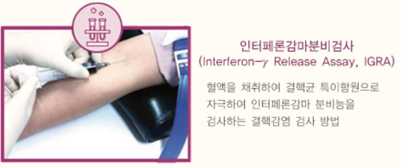 잠복 결핵검사 및 증상&#44; 치료&#44; 비용까지 알아봤습니다. 한국에서 결핵은 남성보다 여성이 노인보다 젊은 세대에 더 많이 발생한다고 합니다. 중요하게 보는 원인은 음식이나 스트레스가 원인인 것으로 보고 있습니다. 어떤식으로 치료가 진행되는지 꼼꼼히 읽어 보시기 바랍니다.