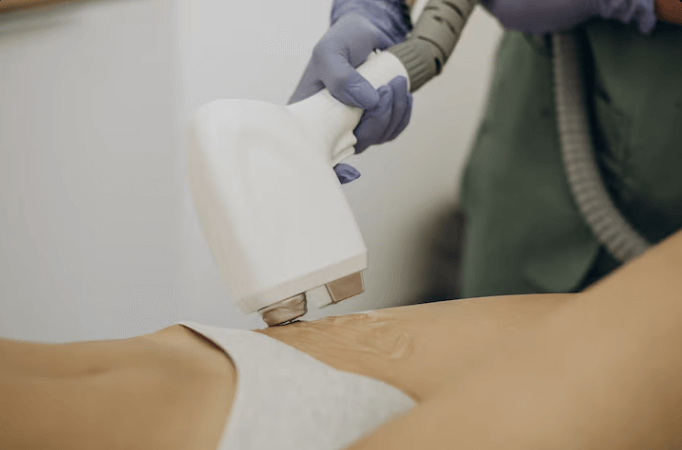 제모 레이저 기기 종류와 피부과 제모 레이저 선택 방법!