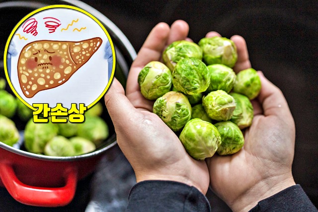 간에 좋은 음식,지방간에 좋은 음식,방울양배추 미니양배추 효능,간암,간경화