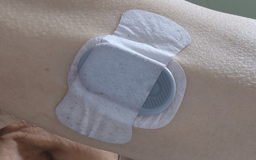 간암 9.12cm/당화혈색소 9.4 &rarr; 5.6 극복기 4편(10개월 만에 당화혈색소 5.6% 달성 비법)