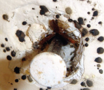 빈대 물린 증상과 치료 