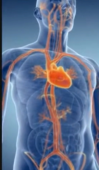 뇌경색 전조증상