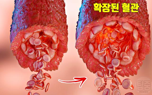 샤워 어지러움 히트쇼크 증상 예방 혈관 확장