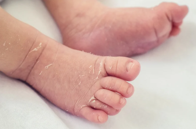 신생아 피부 관리법과 주의할 점