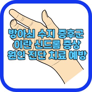 방아쇠 수지 증후군 이란 신드롬 증상 원인 진단 치료 예방