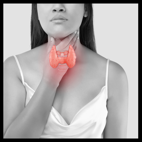 갑상선항진증