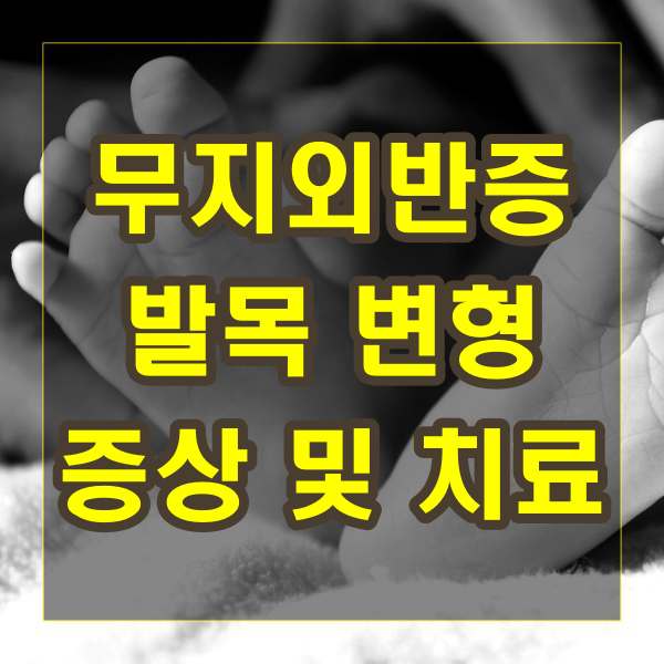 무지외반증으로 인한 발목의 변형과 증상