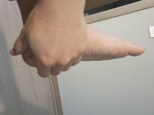 발뒤꿈치 통증 모습