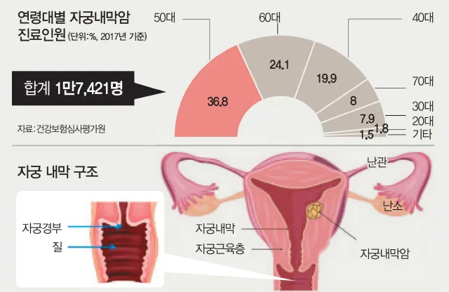 출산 후 자궁수축 기간_6