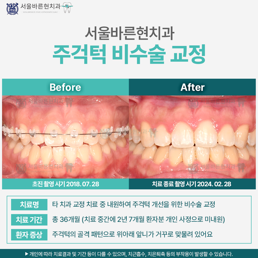 해운대교정치과