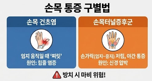 손목터널증후군 자가 진단 & 스트레칭법