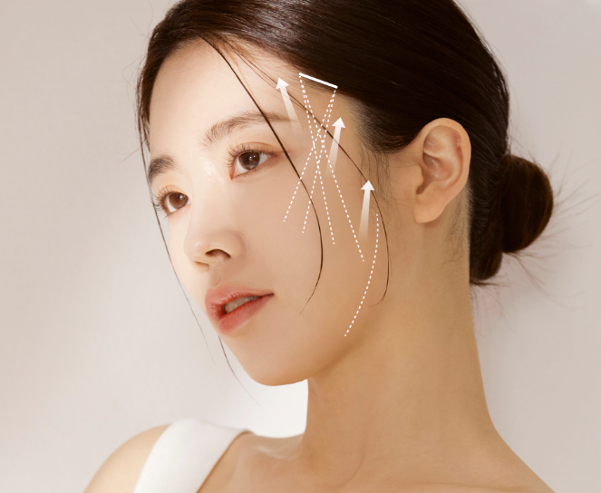 실리프팅 리프팅효과 PDO실 PCL실 피부처짐 피부탄력 안티에이징 실리프팅효과 얼굴리프팅 비수술리프팅