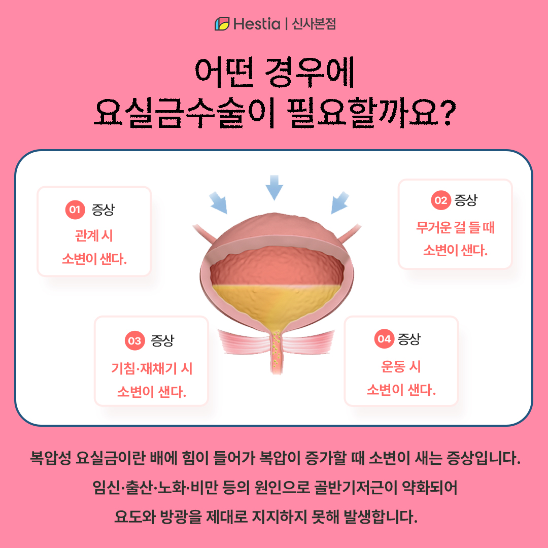 어떤 경우 요실금수술이 필요하죠?