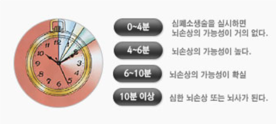 심장충격기사용방법